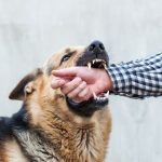 DogBiteHand