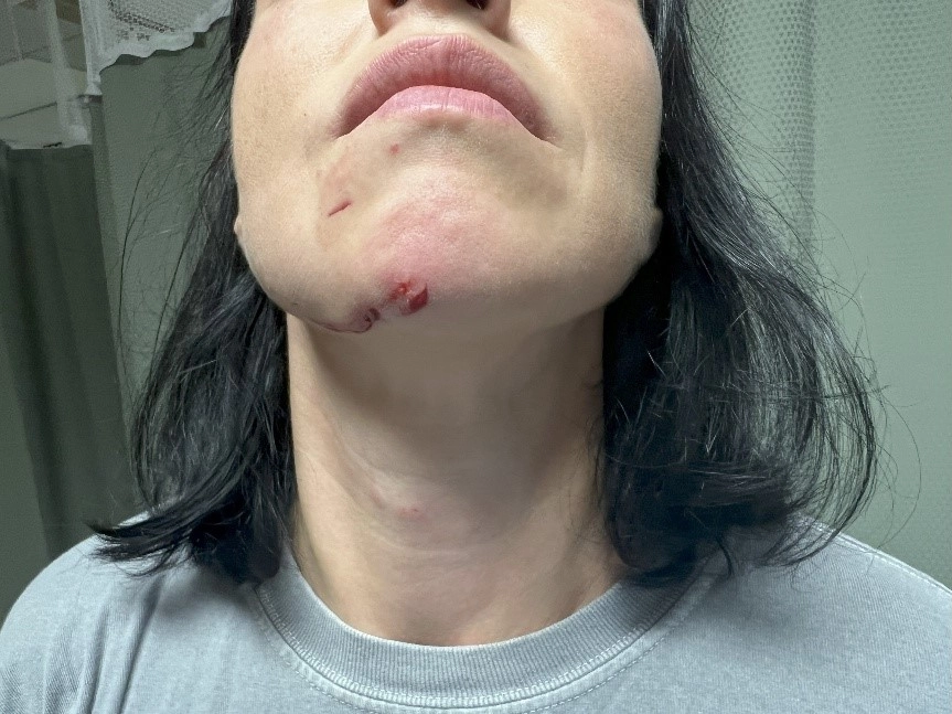 Client Photo